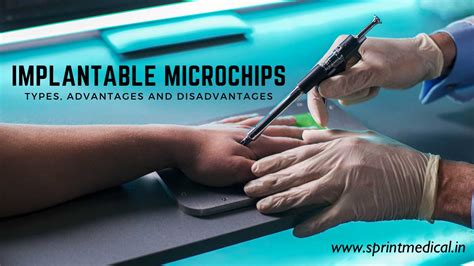 implant rfid chips humans|Microchip implant (human) .